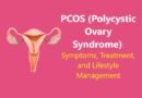 PCOS (Polycystic Ovary Syndrome): Symptoms, Treatment, and Lifestyle Management