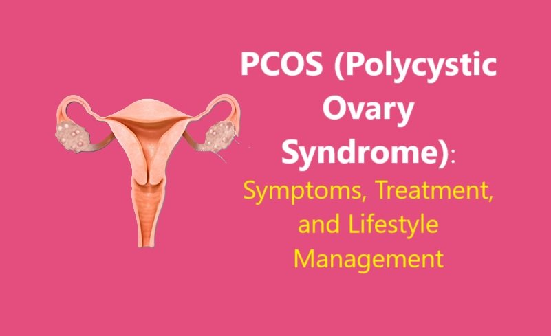 PCOS (Polycystic Ovary Syndrome): Symptoms, Treatment, and Lifestyle Management