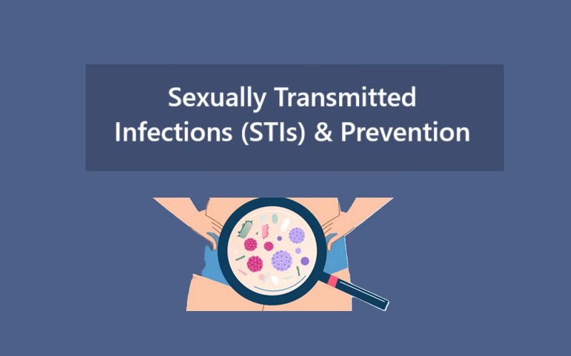 Sexually Transmitted Infections (STIs) & Prevention